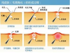 玛恩皮肤修复,玛恩皮肤医疗美容怎么样