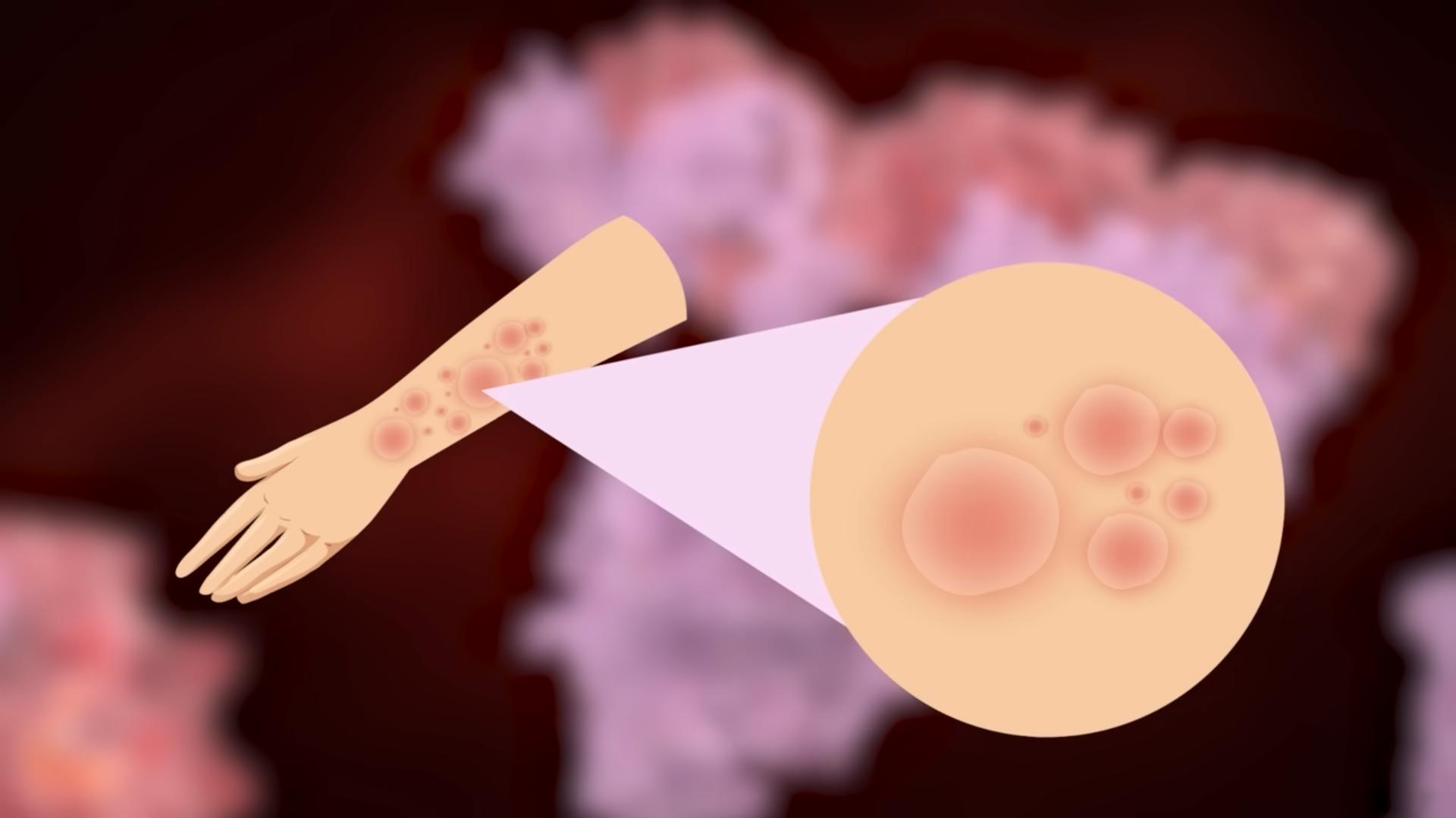 世界上最危险的十种树排行完整,史上最危险的4种树