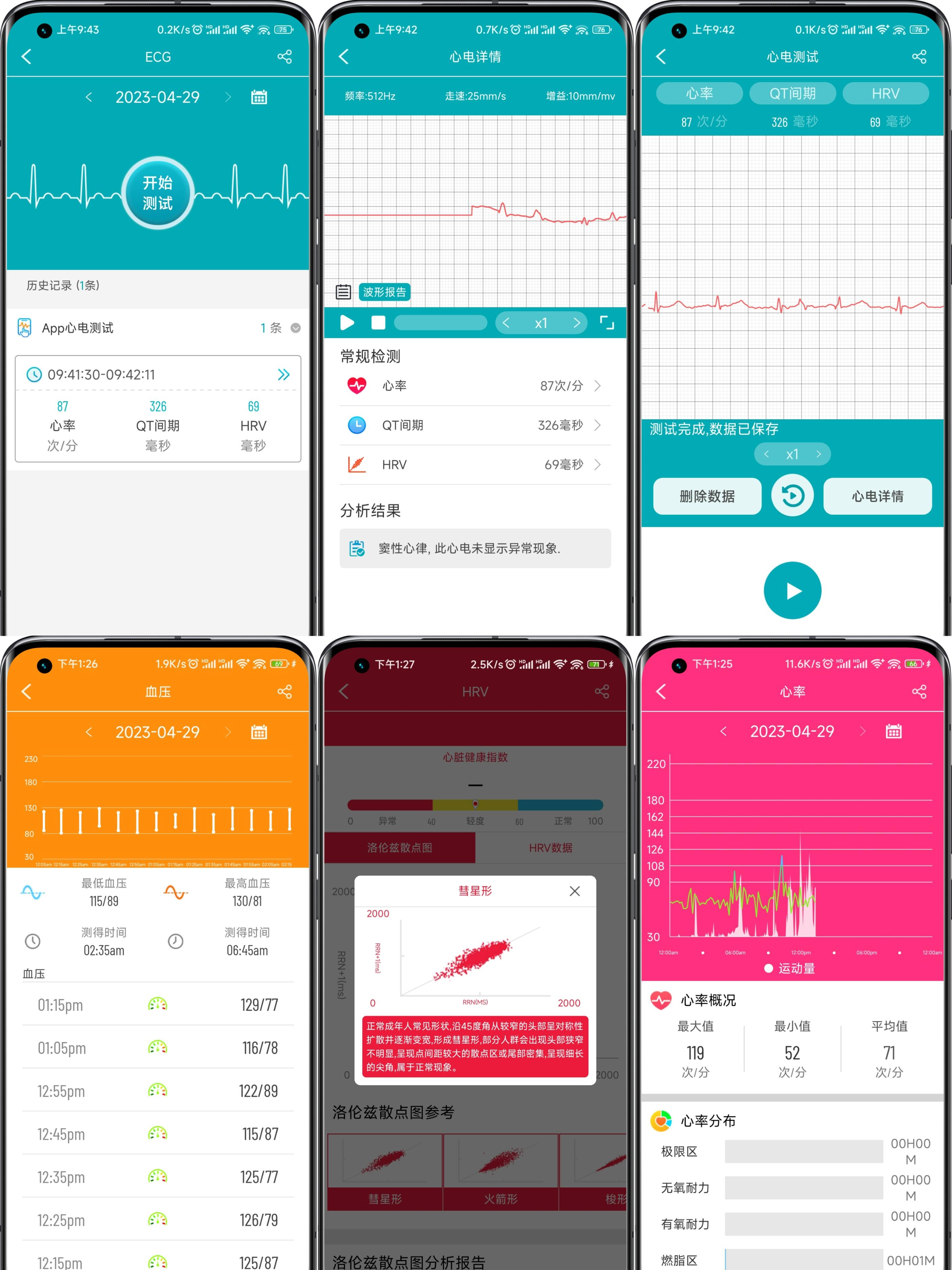 didoe55智能手表靠谱吗,dido智能手表哪款健康监测最好
