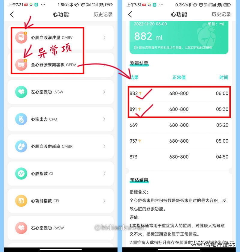 无需采血，腕上全身体检，近三千的智能腕表didoY16S到底值不值？