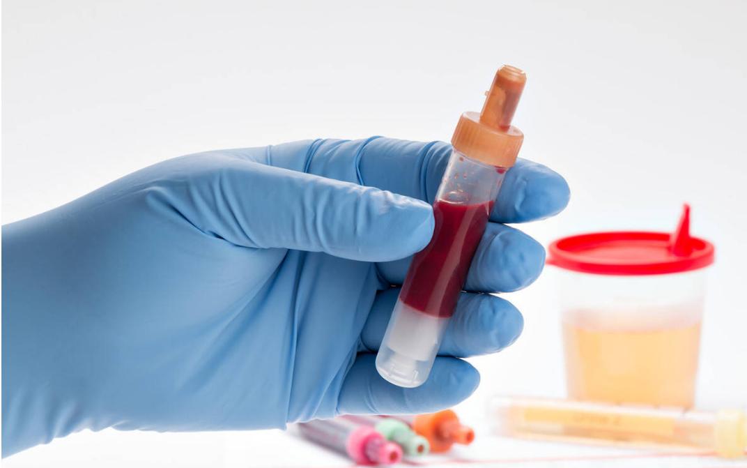 吃降压药十几年了会伤肾吗,降压药吃多了伤肾吗