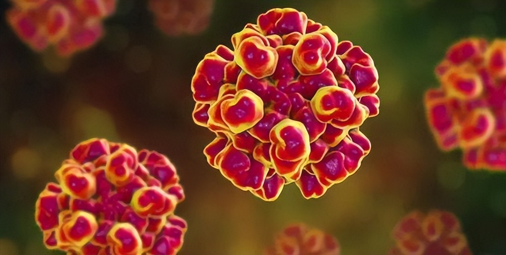 带状疱疹剧痛中医治疗,有一种剧痛叫带状疱疹