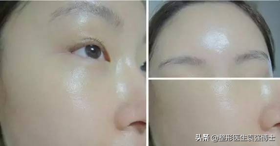 40岁的女人要做哪些简单医美,女人40做什么医美项目