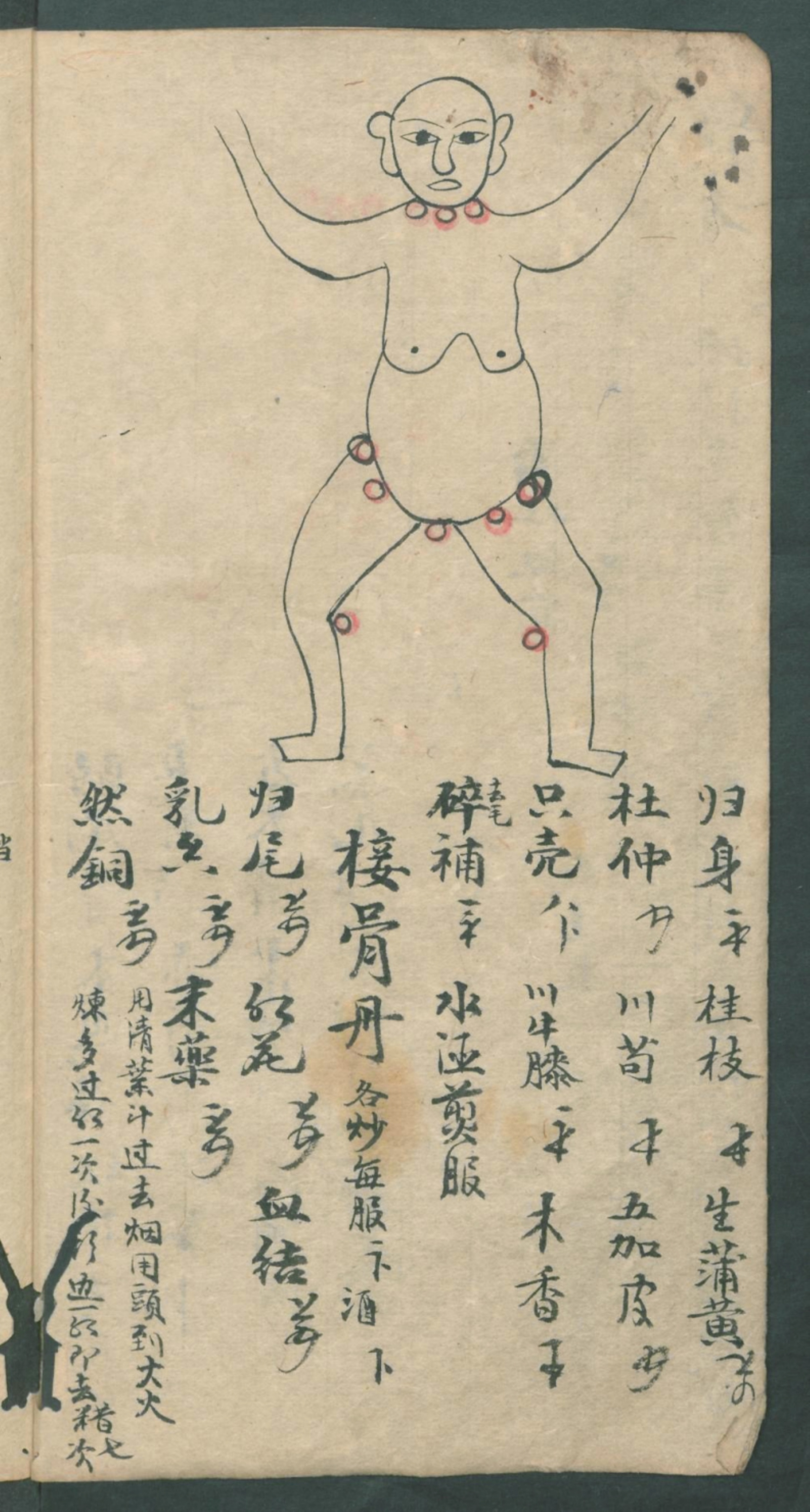 秘传跌打秘方,秘传跌打药方