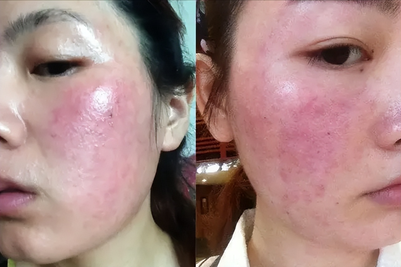 空调房待久了干燥,空调房呆久了皮肤干燥怎么办