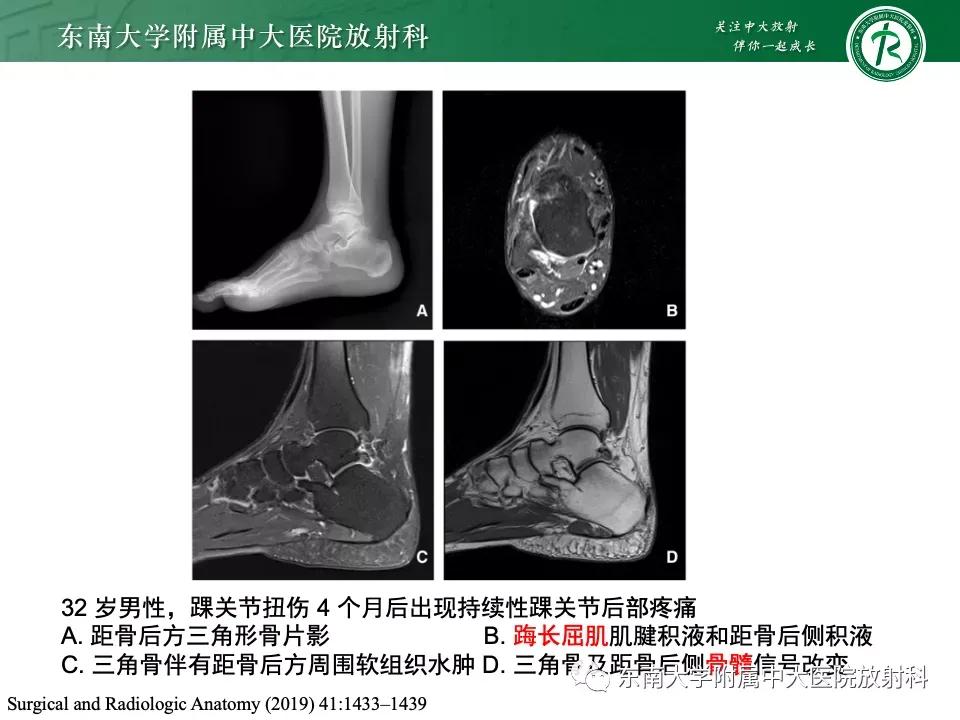 好文分享-《肌骨系统疾病——副舟骨综合征》
