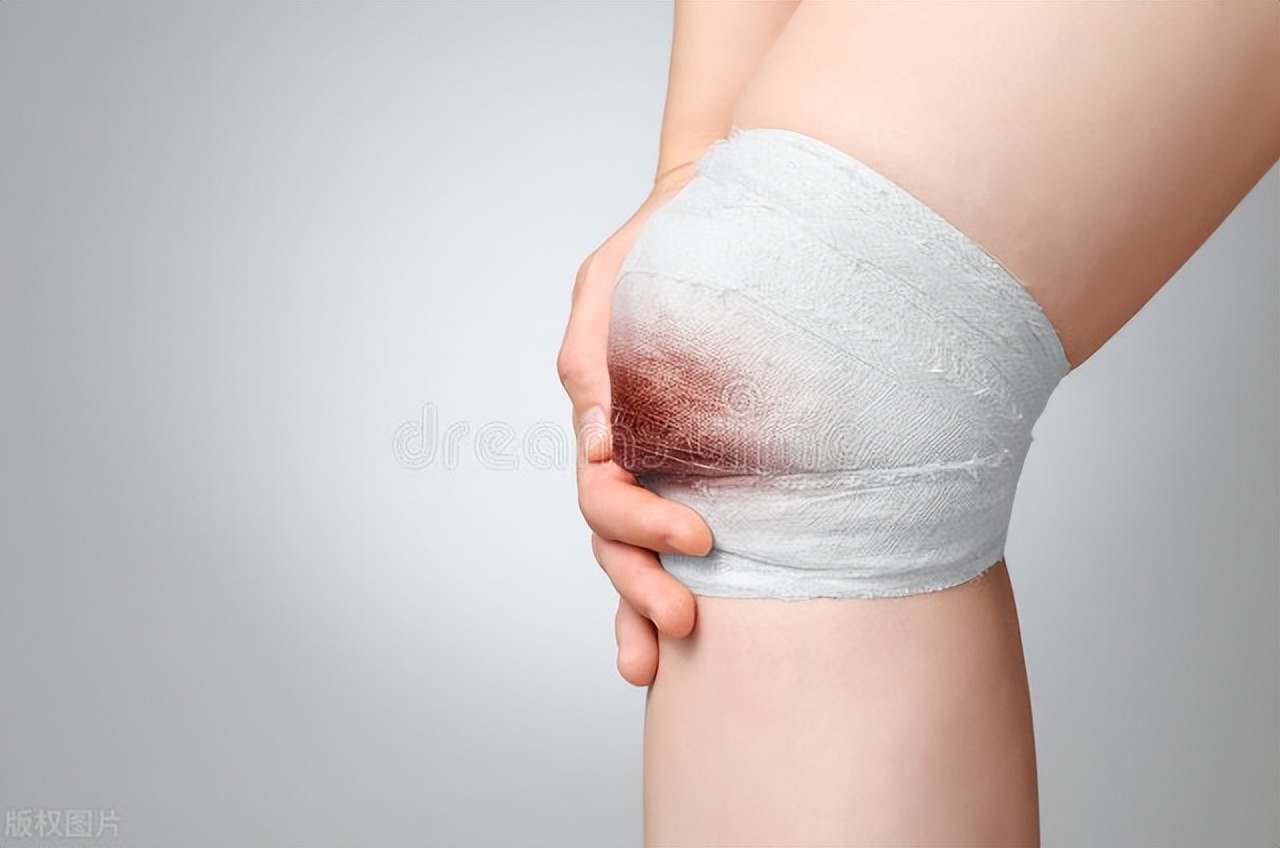 伤口包住还是敞开利于恢复,伤口密闭还是打开