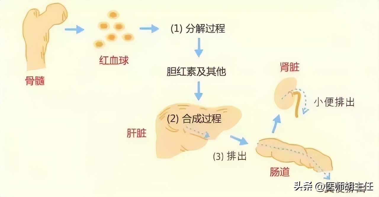 体检发现胆红素高是怎么回事,体检胆红素高怎么快速降下来