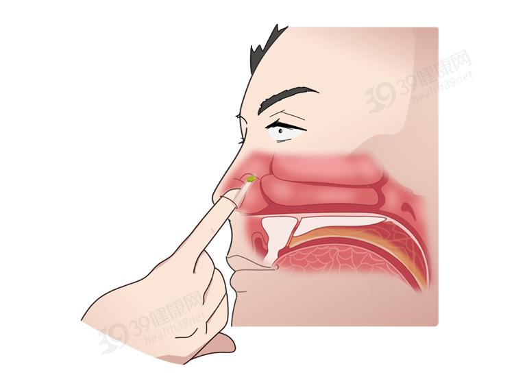 经常爱挖鼻孔的人会面临哪些问题,爱挖鼻孔的人最终将承受三种结果
