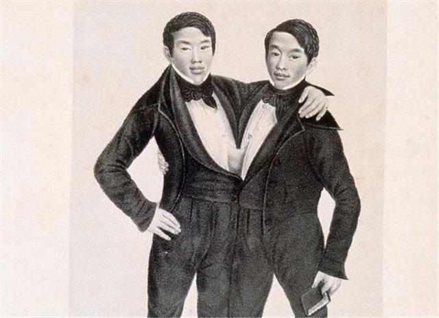 泰国连体人邦克,连体人结婚生子