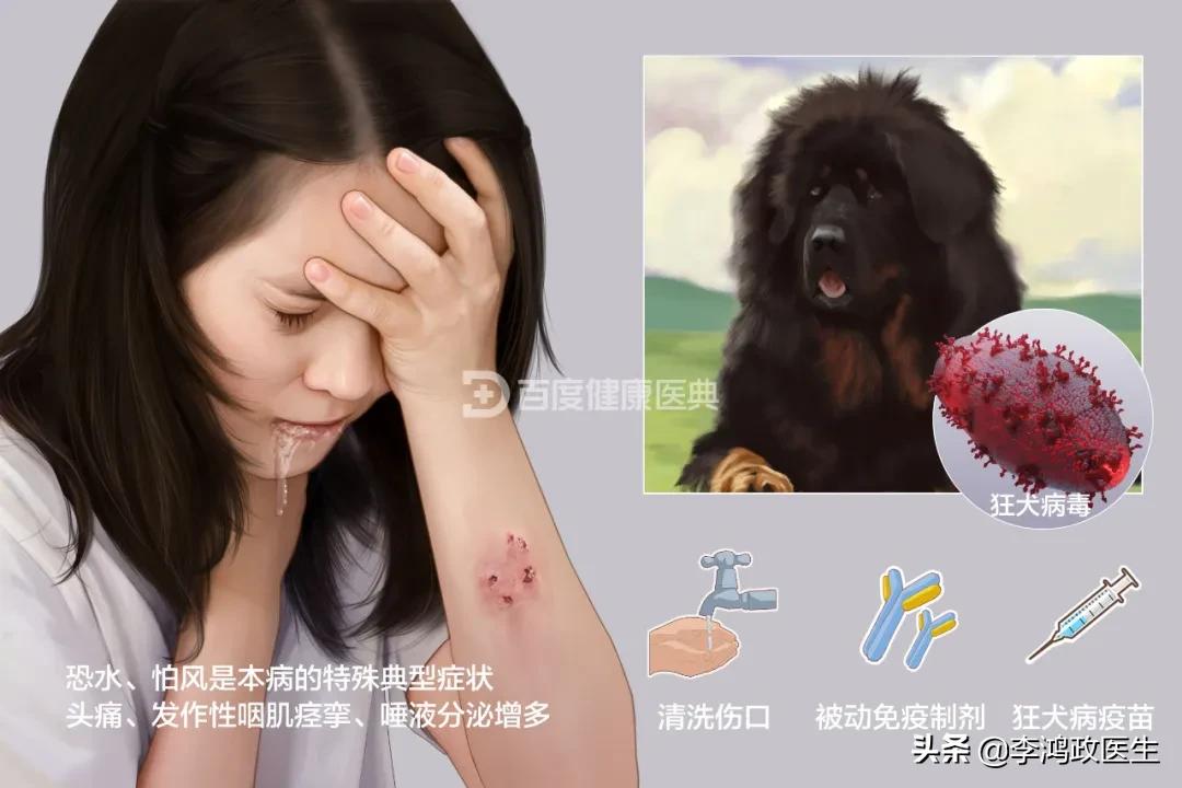 发低烧是狂犬病的前兆吗,女子高烧39度以为普通病