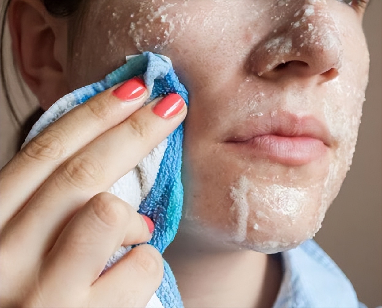 脸上起皮了是怎么回事,脸上起皮是什么原因怎么办