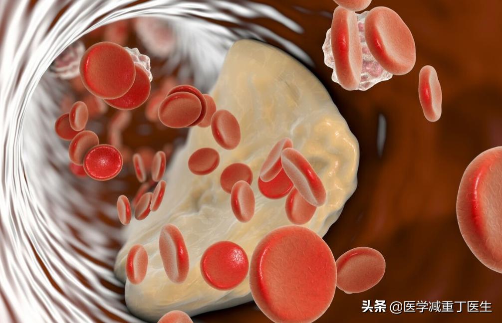 司美格鲁肽控糖亲身经历,司美格鲁肽是降血糖的吗