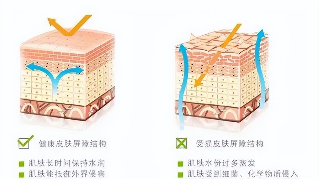 头屑多脱发怎么去除小妙招,头屑如何调理生发最有效