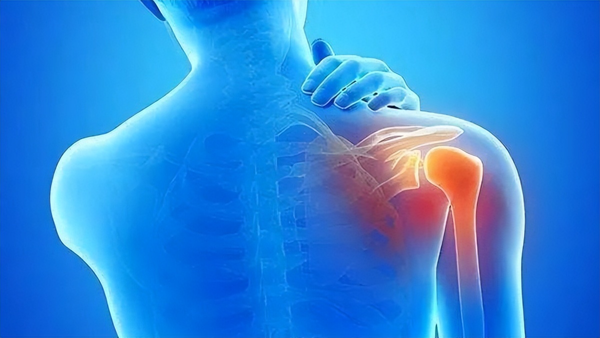 肩膀疼痛要警惕的三种病肩周炎,肩周炎是什么原因造成的肩膀痛