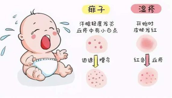 夏天脖子上起的是痱子还是湿疹呢,夏季孩子湿疹痱子不断