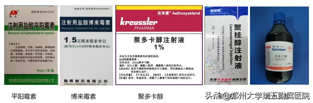 健康科普治疗结节,静脉畸形有硬肿块要做手术吗