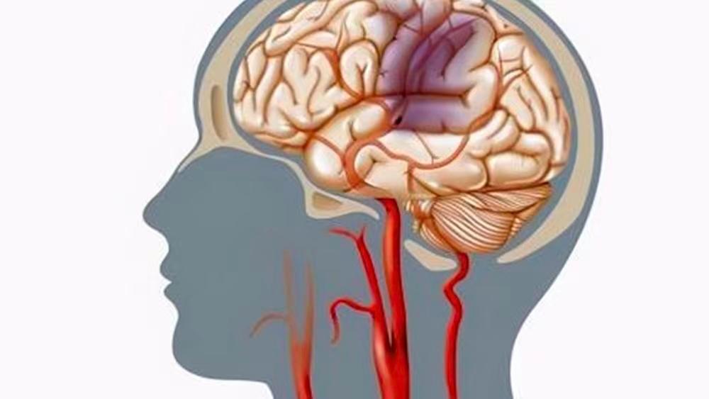 50岁ct查出脑轻度萎缩正常吗,50岁检查脑缺血怎么回事