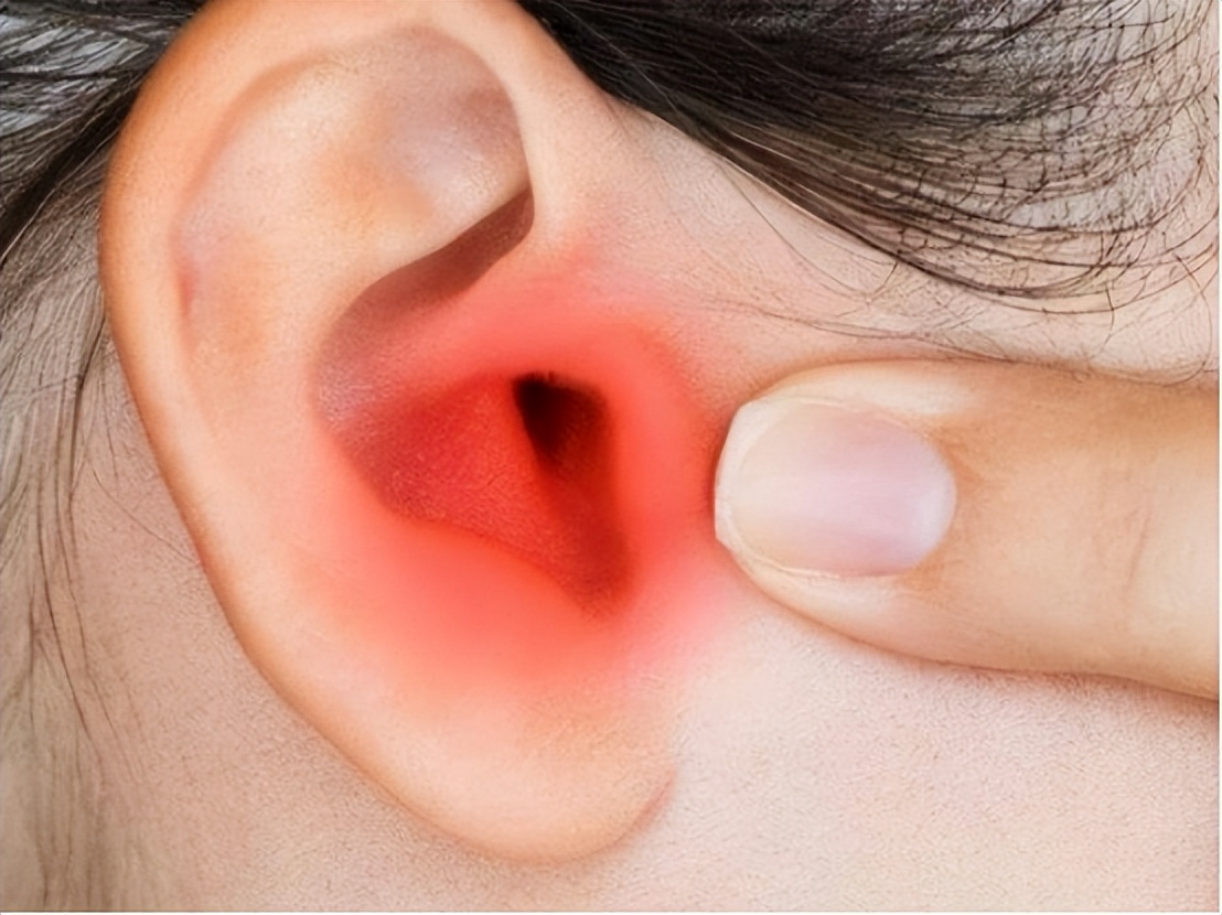 分泌性中耳炎是什么，为什么儿童得病几率更大，要怎么治疗