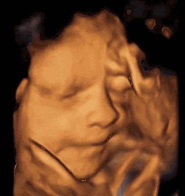 做四维的最佳时间是多少周？最新《孕前和孕期保健指南》告诉孕妈