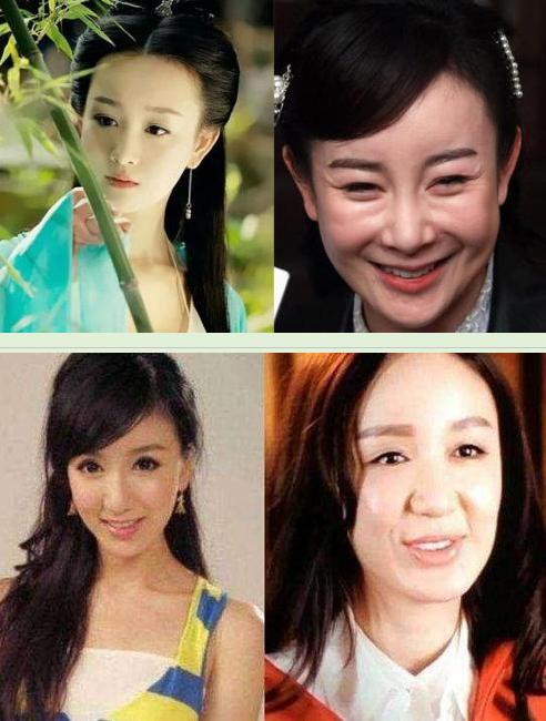 秦海璐澄清,秦海璐承认整容真的吗