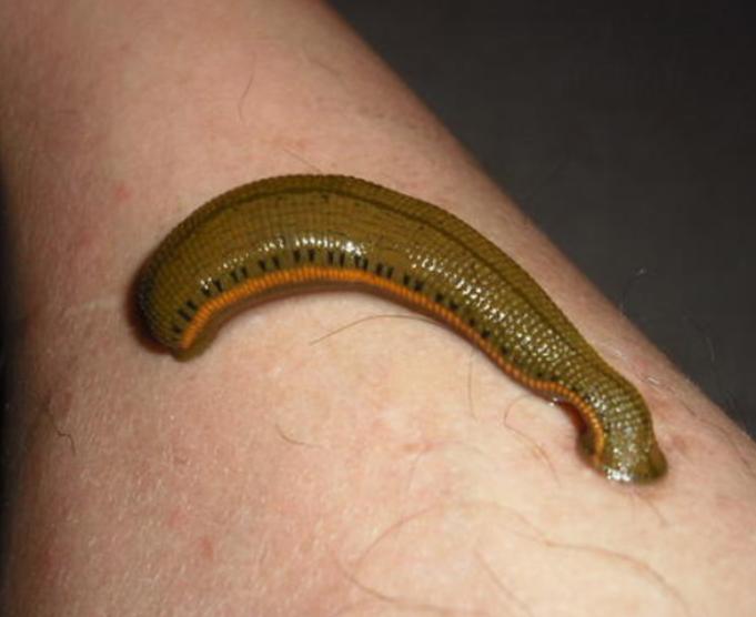 男孩喝生水取出蚂蟥,云南5岁男孩取出蚂蝗