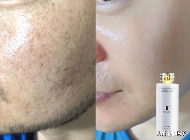 天生肤色是黑如何让皮肤变白,怎样使皮肤变白的简单方法