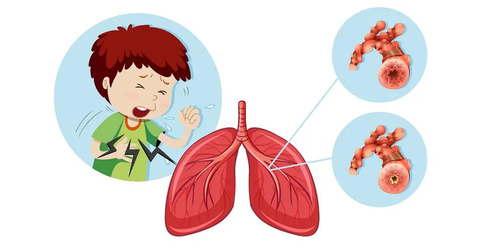 50多岁咳嗽冬天厉害吃药也不好,一到冬天咳嗽夏天没事
