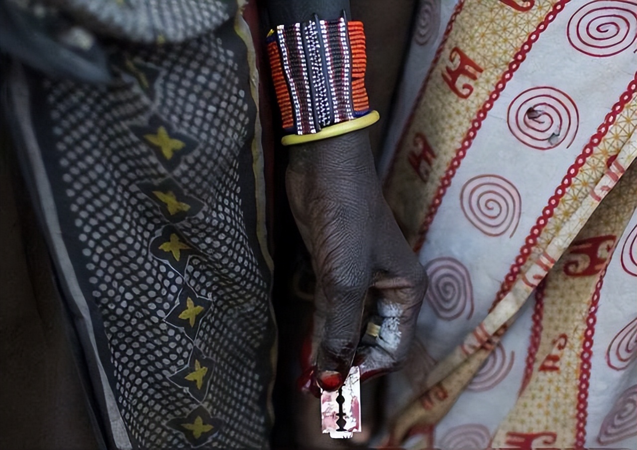 被切掉生殖器官的真实案件,被切掉重要器官的女人