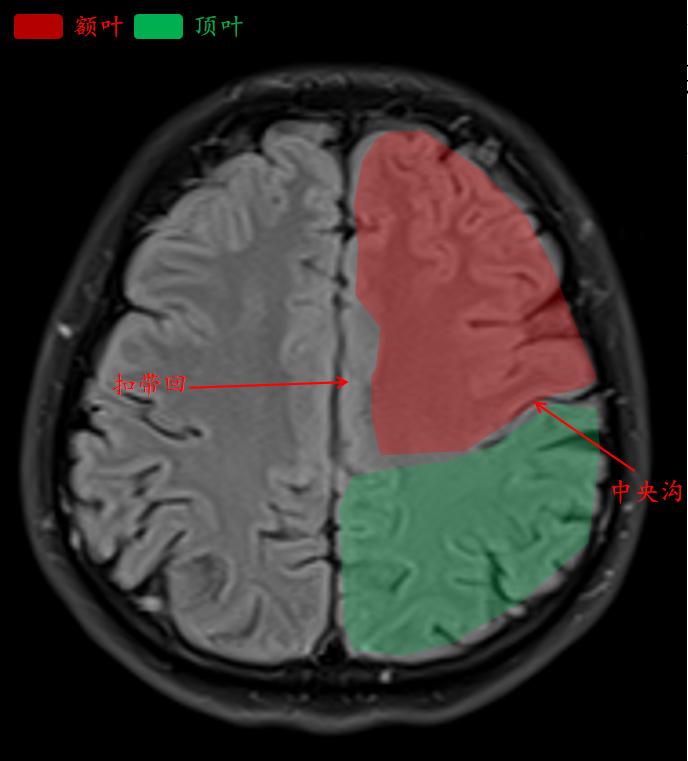 肘关节mri图谱大全,腕关节mri解剖图谱