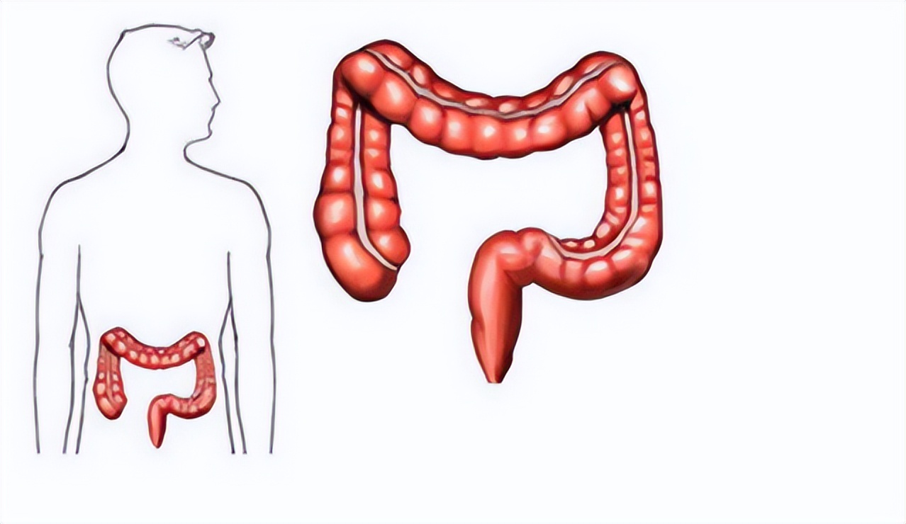 男子灌肠排出大量粪便,男子用大肠灌小肠