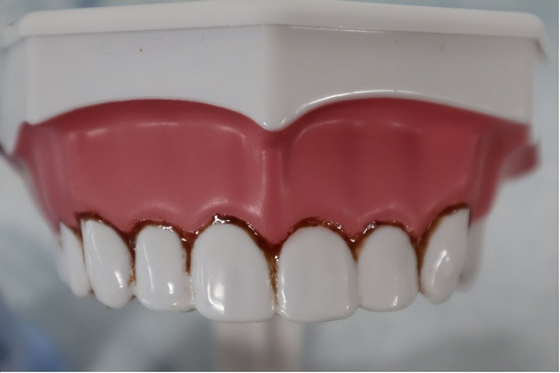 飞利浦儿童电动牙刷平替刷头测评,飞利浦三款儿童电动牙刷对比