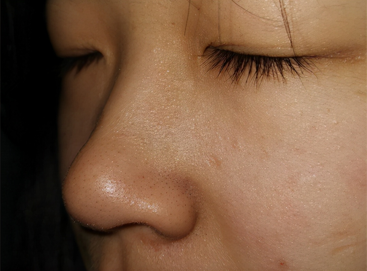 男人脸黑红是怎么回事,脸又黑又肿是什么原因