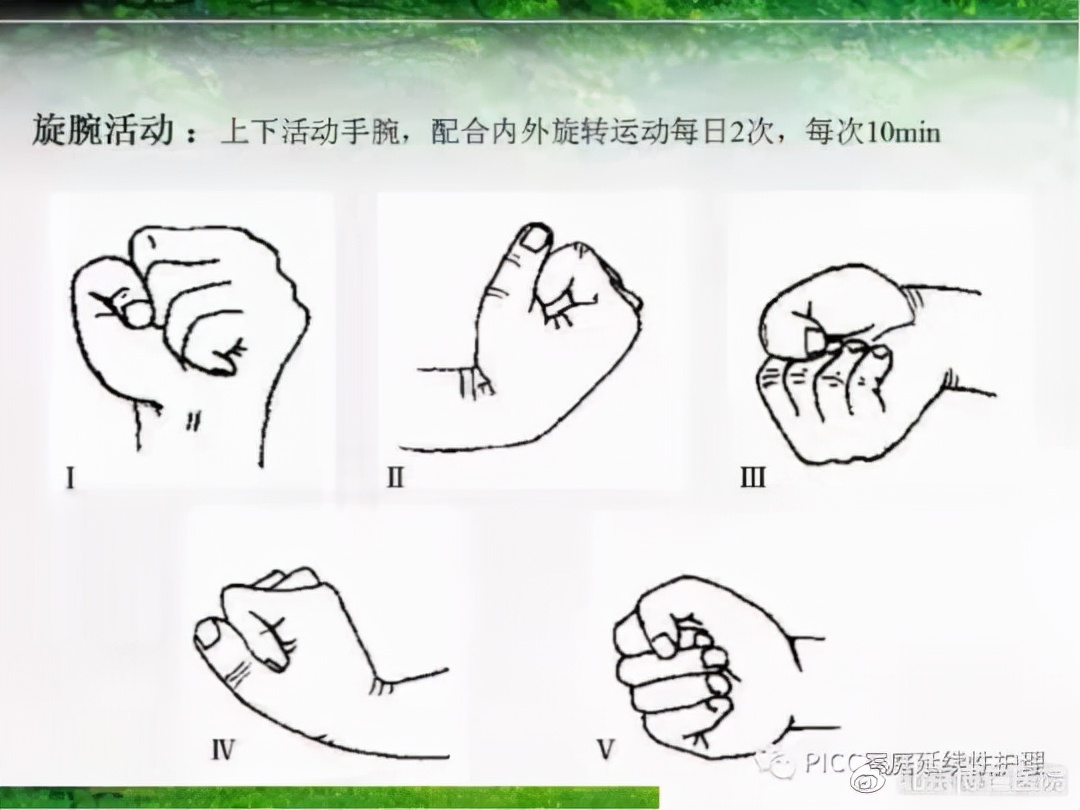 不扎针的输液管,不扎留置针静脉输液