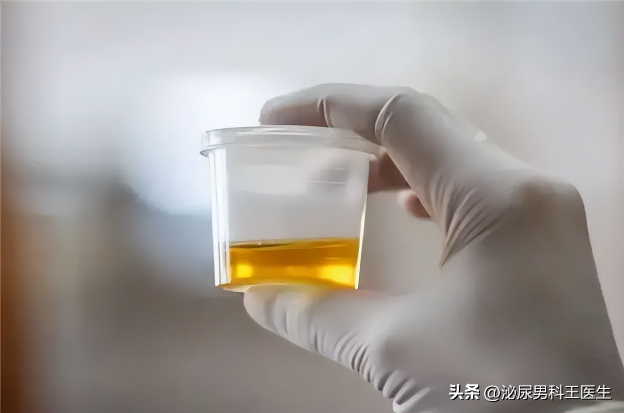 尿毒症注意三个坏习惯,为何尿毒症越来越多医生直言