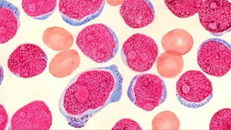 得了带状疱疹又痛又痒医生提醒,有不疼的带状疱疹症状和表现