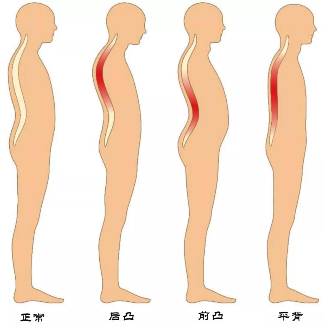 脊柱微创潘医生,脊柱微创初印象