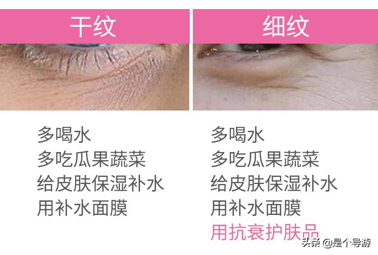 眼角有细纹干纹可以擦维生素e吗,眼睛下的细纹是怎么造成的