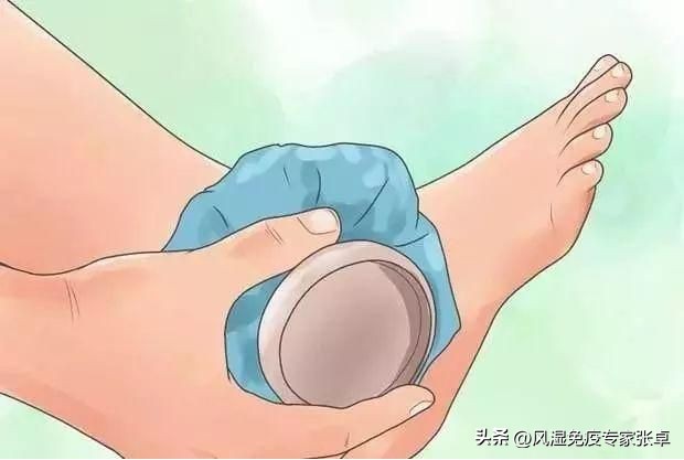 突然痛风怎么快速止疼,痛风吃什么药可以快速止疼