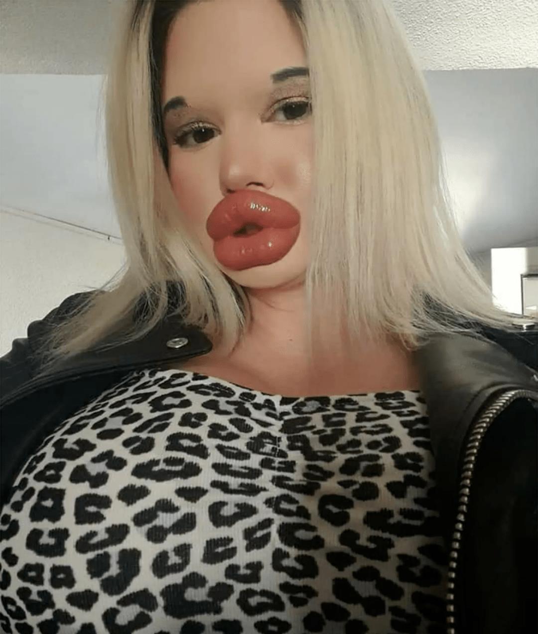 全网最厚嘴唇女网红,整容很多次网红厚嘴唇