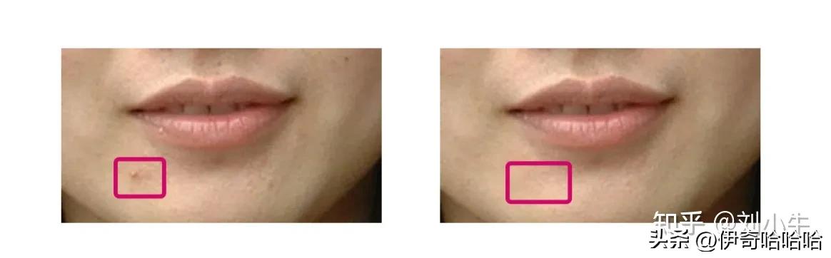 ps修复工具和仿制图章的区别,修复画笔工具和仿制图章工具区别