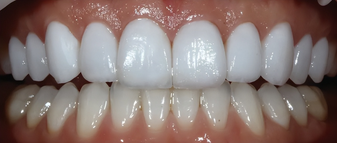 鍙h厰鍖荤枟鍣ㄦ琛屼笟鏂伴椈,鍙h厰鍖荤枟鏉垮潡閫氱瓥鍖荤枟