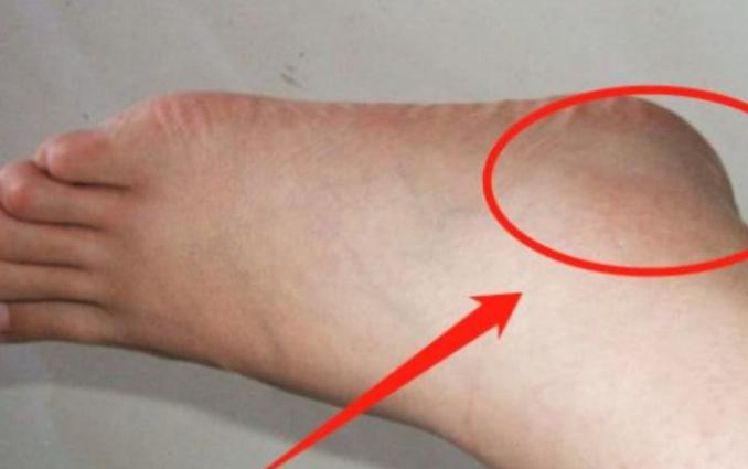 长期喝酒不怎么排尿,喝酒不排尿和排尿哪个好