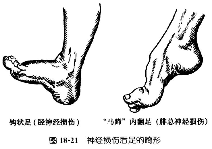 脊神经支配区域解剖图简图,脊神经及其分支的支配范围