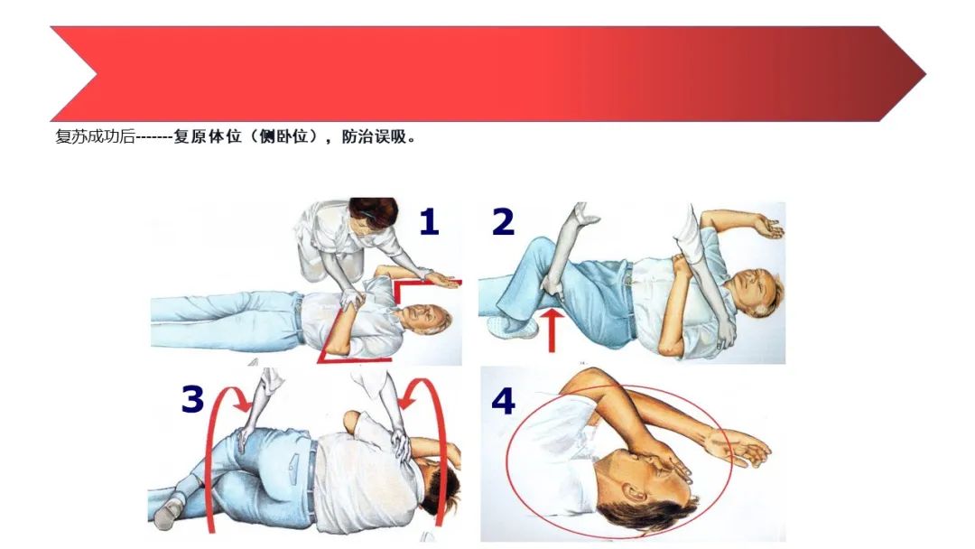 人工呼吸与心肺复苏操作方法ppt,心肺复苏技术ppt2021