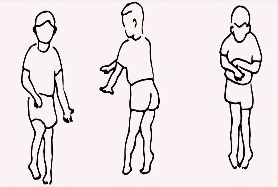 脑瘫在中医里的诊断和治疗,你知道脑瘫病的早期症状是什么