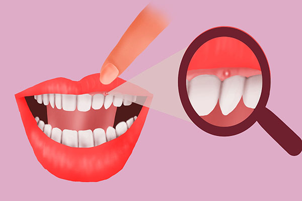 禁售槟榔的危害,新型槟榔有危害吗