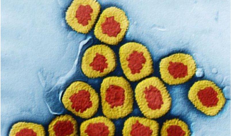 世界上最致命的病毒九种,细菌和病毒哪个更致命