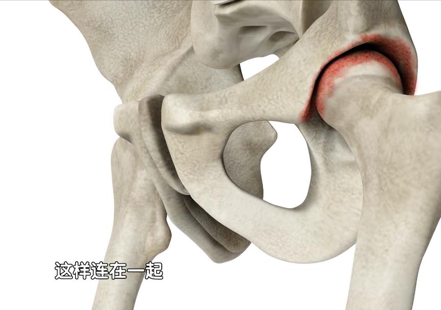 早期发现股骨头坏死能不能治,股骨头坏死如何防止病情加重