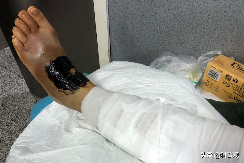 农户家中惊现两米长剧毒眼镜王蛇,3米长眼镜蛇被狗咬